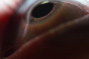 Eye